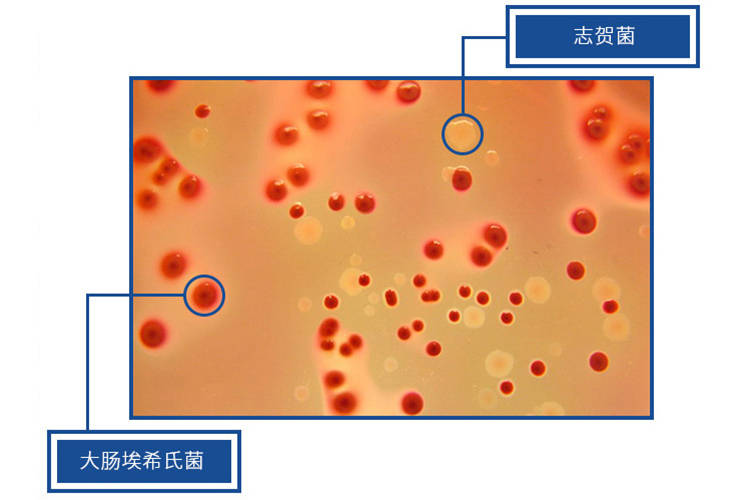 食品中志賀氏菌要檢測(cè)哪些東西？志賀氏菌的檢測(cè)方法及標(biāo)準(zhǔn)解析